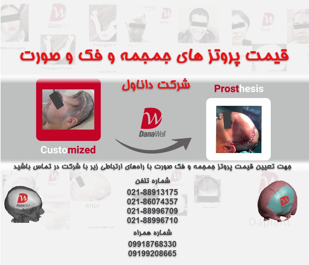قیمت پروتز جمجمه و فک